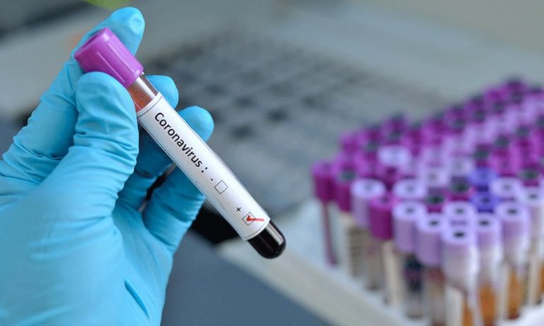 6 إصابات جديدة في مزبود والعدد الى 15 اليوم