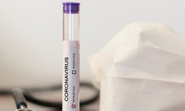 لا اصابات بالكورونا في  زبدين الجبيلية