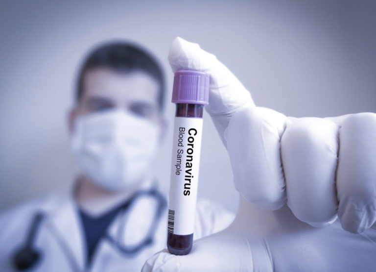 إصابة بكورونا لابن صاحب محل تجاري في نهر ابراهيم