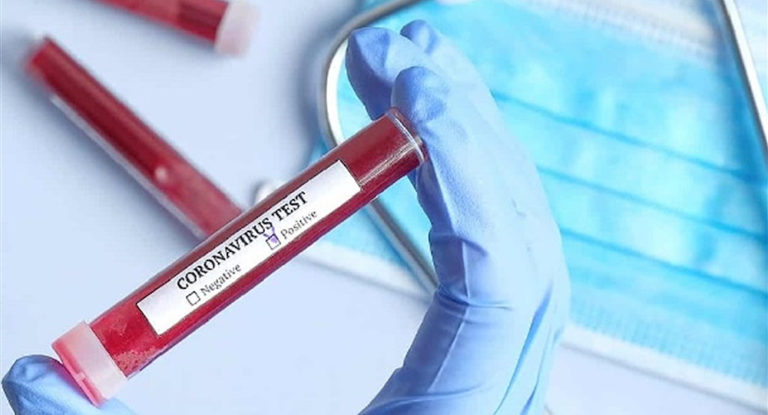 اصابتان جديدتان بكورونا في حصارات