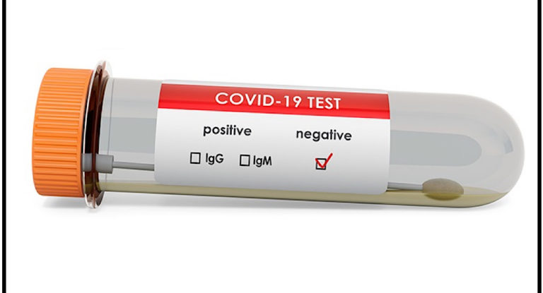 نتائج فحوصات كورونا في وزارة الخارجية سلبية