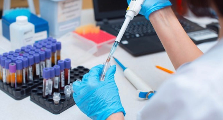 وزارة الصحة : ٤ حالات  وفاة و ٤١٥ اصابة جديدة بفيروس كورونا