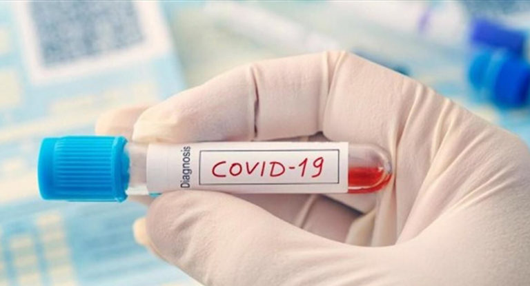 وزارة الصحة : ١٥ حالة وفاة و ١٥١٢ اصابة جديدة بفيروس كورونا