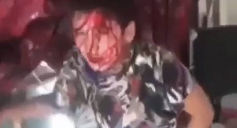 بالفيديو – طفل يتعرض لأشد أنواع التعذيب من والده ووجهه مغطّى بالدماء