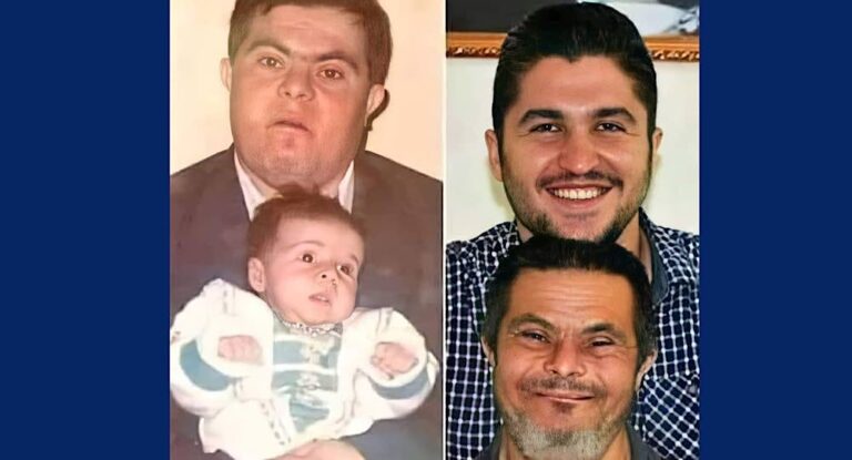 بالصورة – قصة مؤثرة، طبيب يخبر عن والده المصاب بمتلازمة داون.. عمل بجهد ليجعلني طبيباً