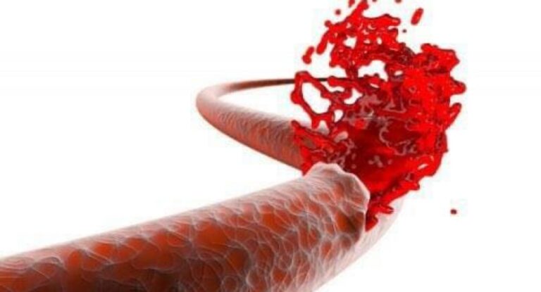 معلومة بتفيدك – ‏لماذا يمنع شرب الماء عند نزيف الدم؟