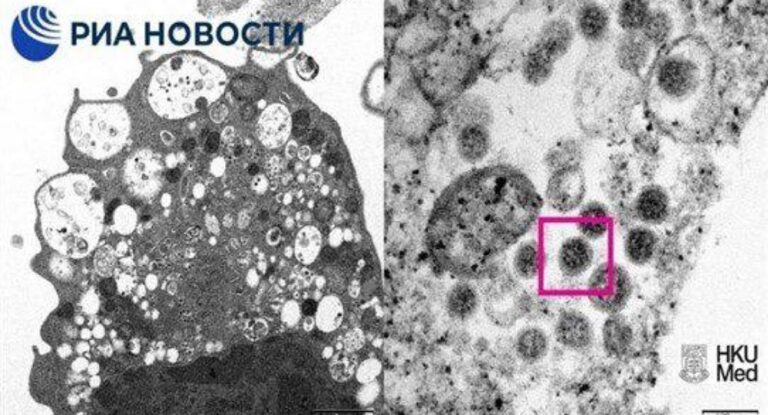 تحذير عاجل لمصابي “أوميكرون” خلال شهر كانون الأول