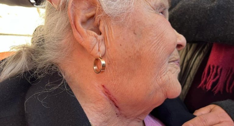 بالصّورة – جرح نهاد الشامي يفتح اليوم  ٢٢ الشهر في ذكرى شفائها