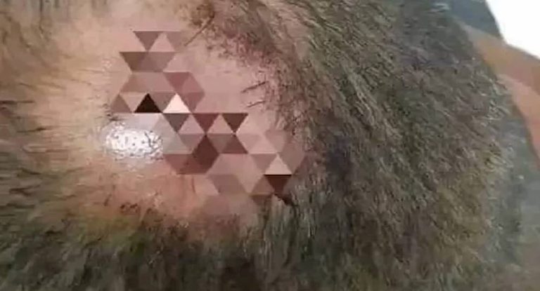 اشتكى من “الشوربة” فضربته زوجته بـ “ركوة” مما استدعى دخوله للمستشفى