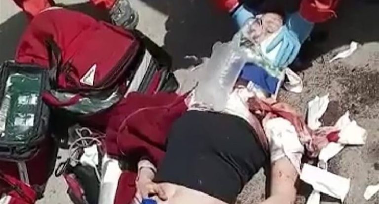 بالصور والفيديو-كلاب شاردة تنقضّ على فتاة وتسلخ شعرها في إهدن