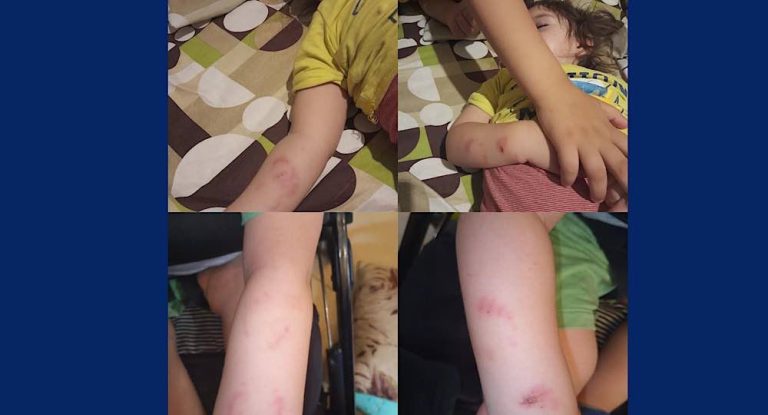 خاص – بالصّور – طفل يتعرّض للتعنيف في حضانة في منطقة جبيل.. وموجة غضب واسعة!